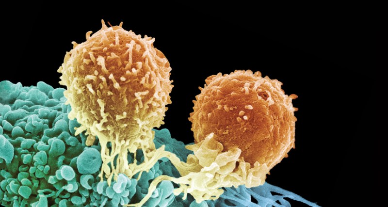 T cells attack a cancer cell