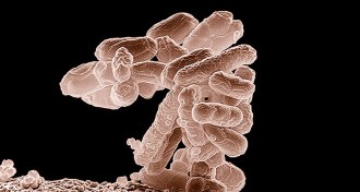 E. coli micrograph