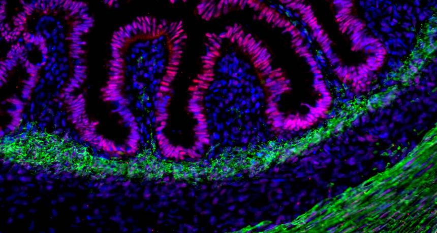 iny specks of human intestinal tissue (stained pink)