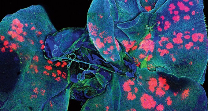 A micrograph of a mouse's lungs