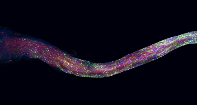 micrograph of mouse's optic nerve