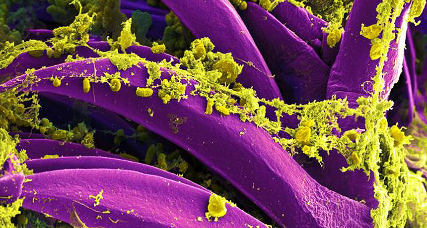 Yersinia pestis bacteria