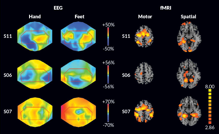 EEG and fMRI for consciousness