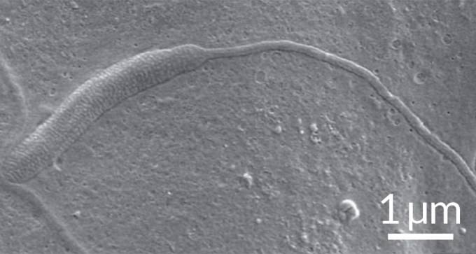 ancient sperm