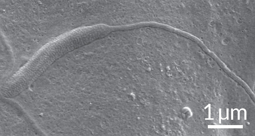 ancient sperm