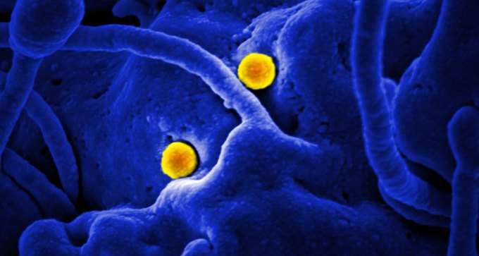 MERS virus particles
