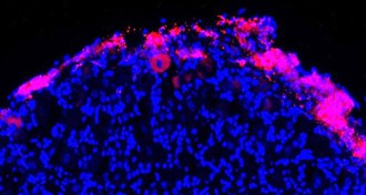 Therapeutic cells (pink)