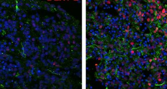 Brainlike structures