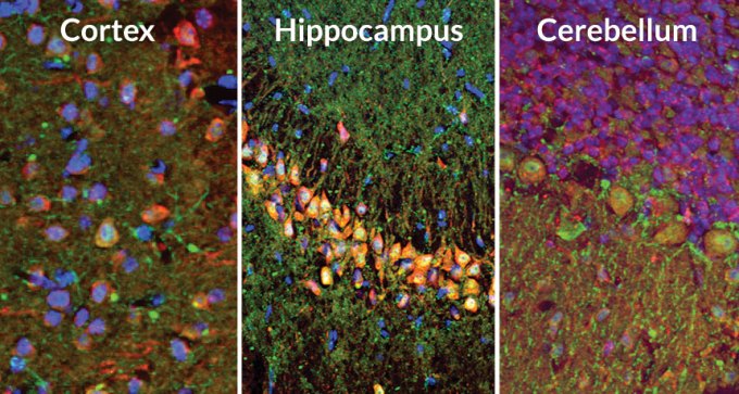 nerve cells from different parts of the mouse brain