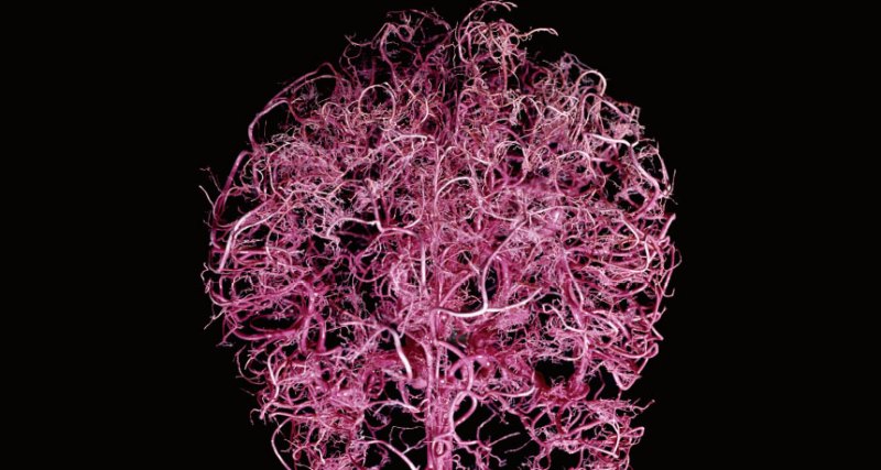 brain blood vessels