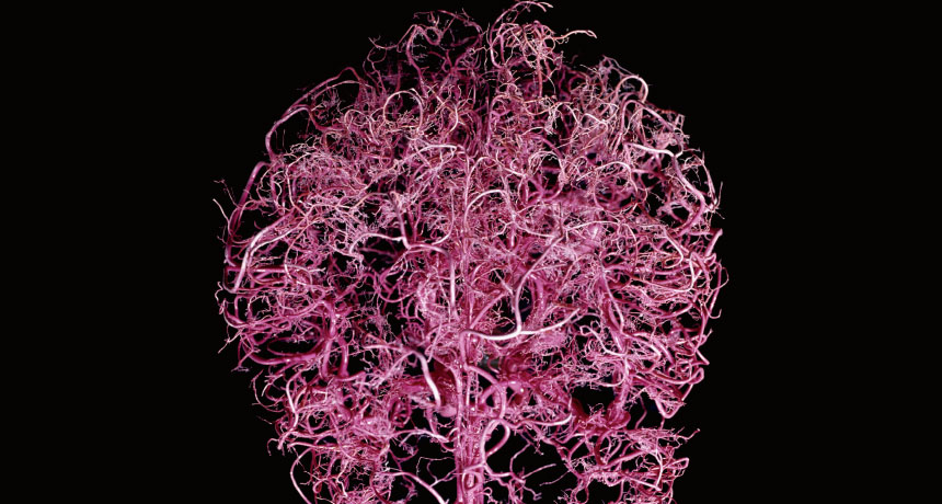 brain blood vessels