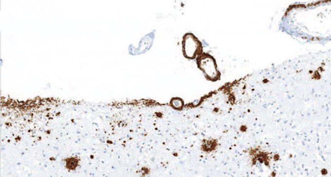 stained brain tissue