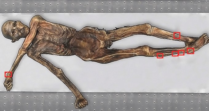 Ötzi the Iceman