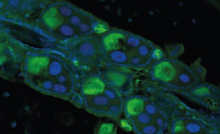 microscope image of Wolbachia bacteria