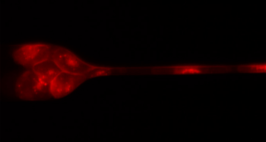 magnified image of cells squeezing through a capillary