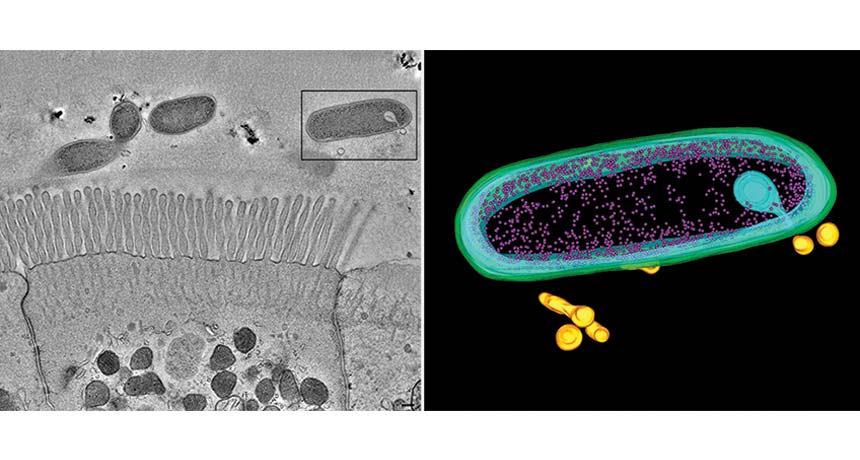 Bacteroides fragilis and intestinal cells