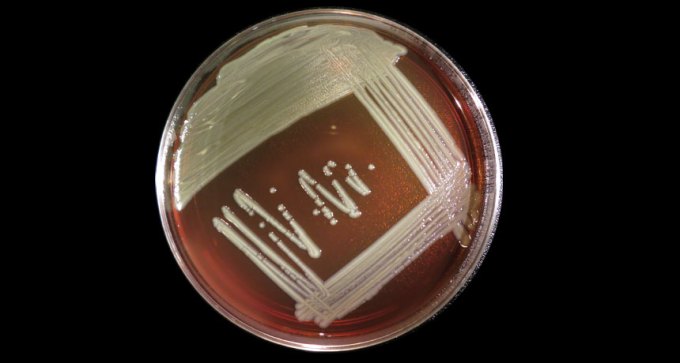 Elizabethkingia bacteria