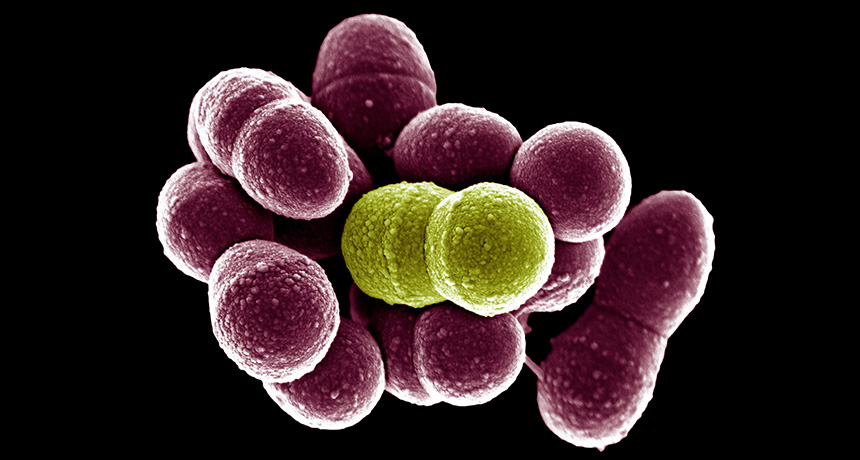 Streptococcus gordonii