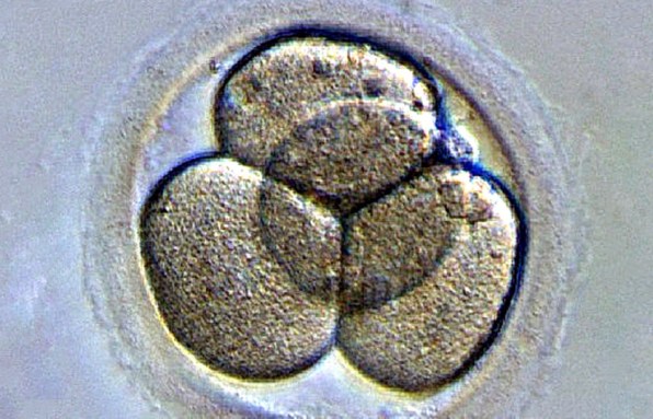 human embryo