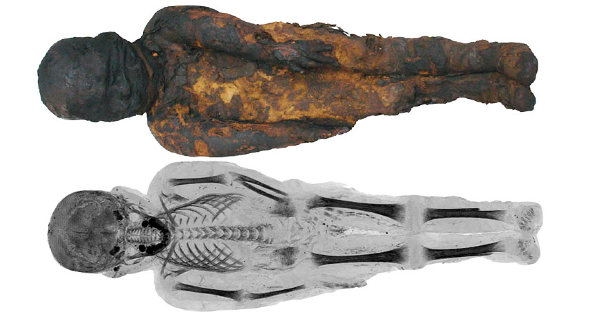 mummy image and CT scan