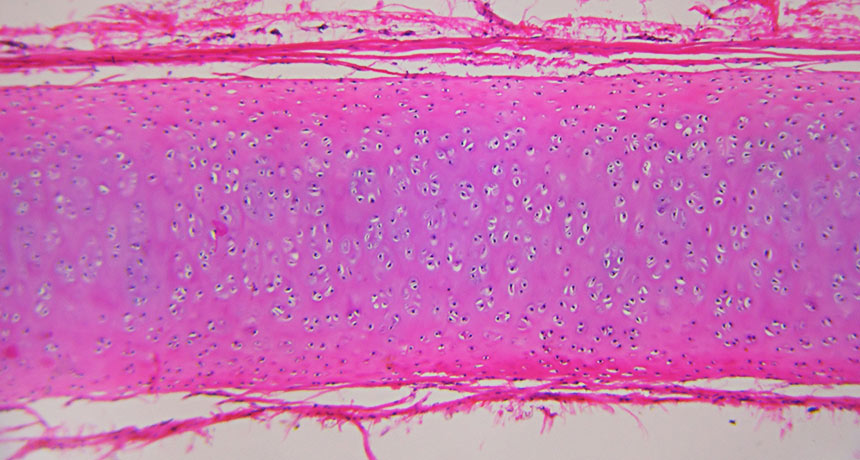 hyaline cartilage