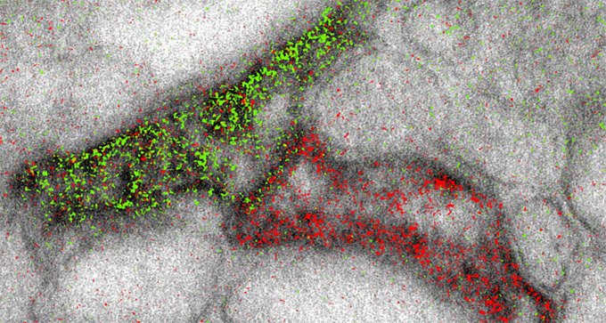 electron microscope image