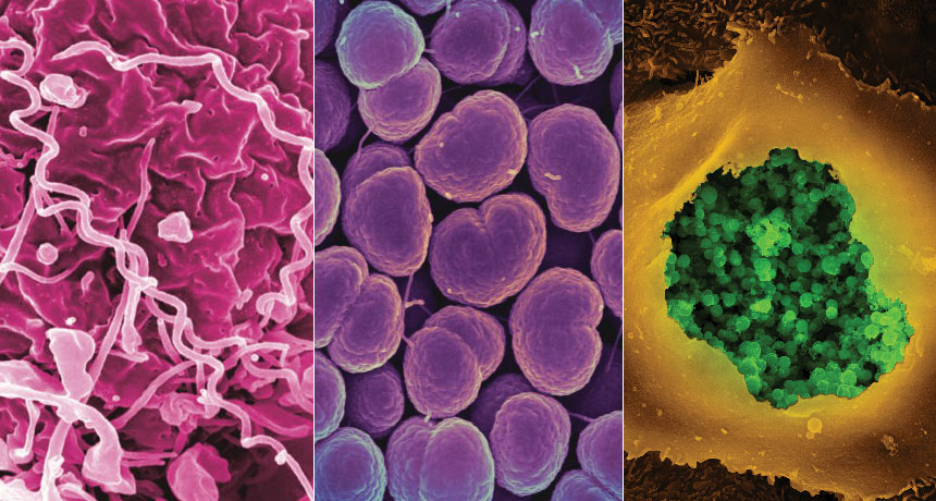 syphilis, gonorrhea and chlamydia