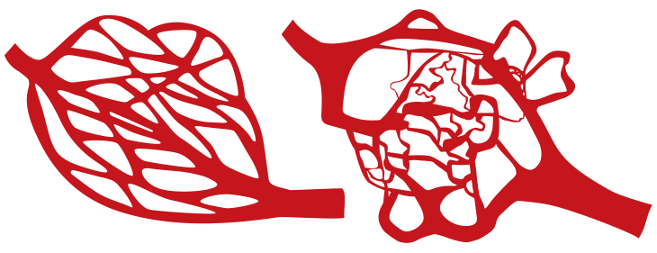 healthy versus cancerous tumor blood vessels
