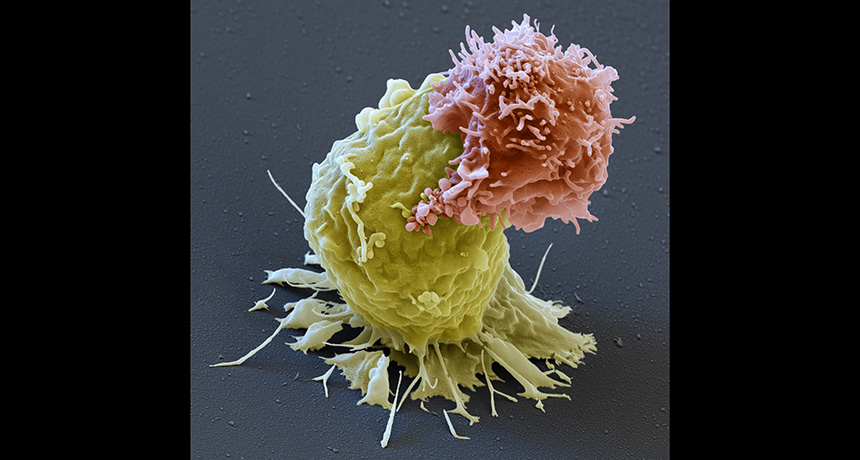 CAR-T cell attacking a leukemia cell