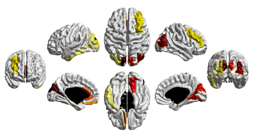 rapidly growing baby brains