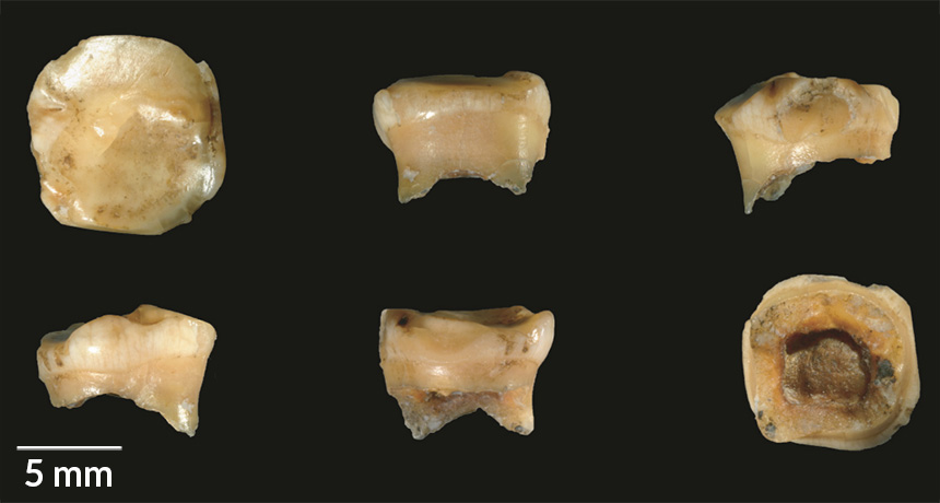 Denisovan fossil teeth