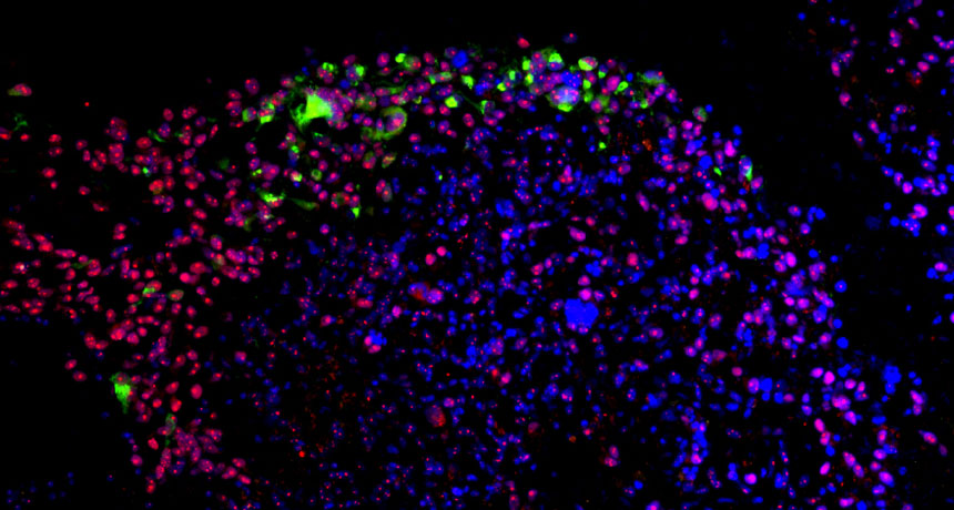 Zika virus and stem cells