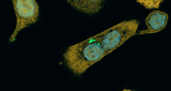 human pancreatic cells
