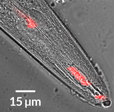 Caenorhabditis elegans