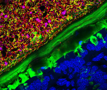 bacteria growing in a mouse intestine