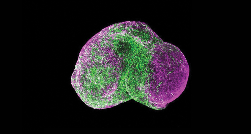 organoid brain