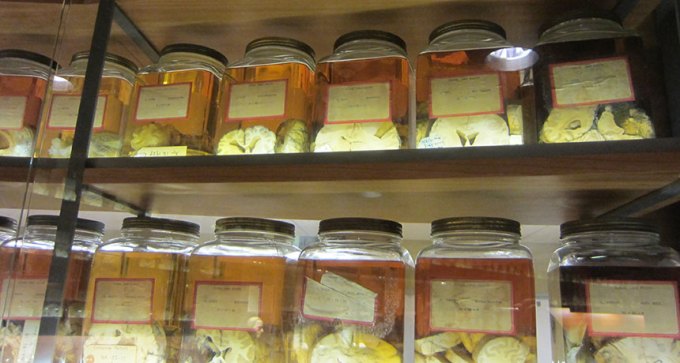 Yale medical school library brain samples