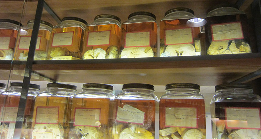 Yale medical school library brain samples