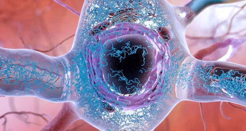 tau tangles in a nerve cell illustration