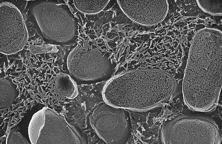 a microscopic image of E. Coli