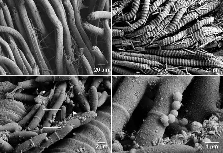 scanning electron microscopy