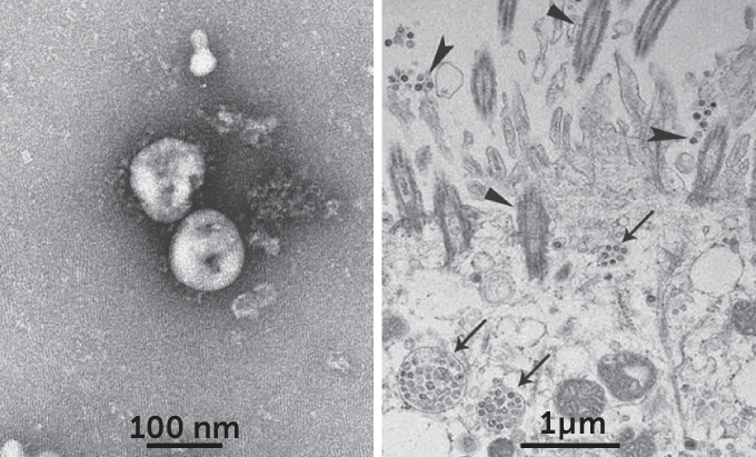 2019-nCoV close-up and viral particles