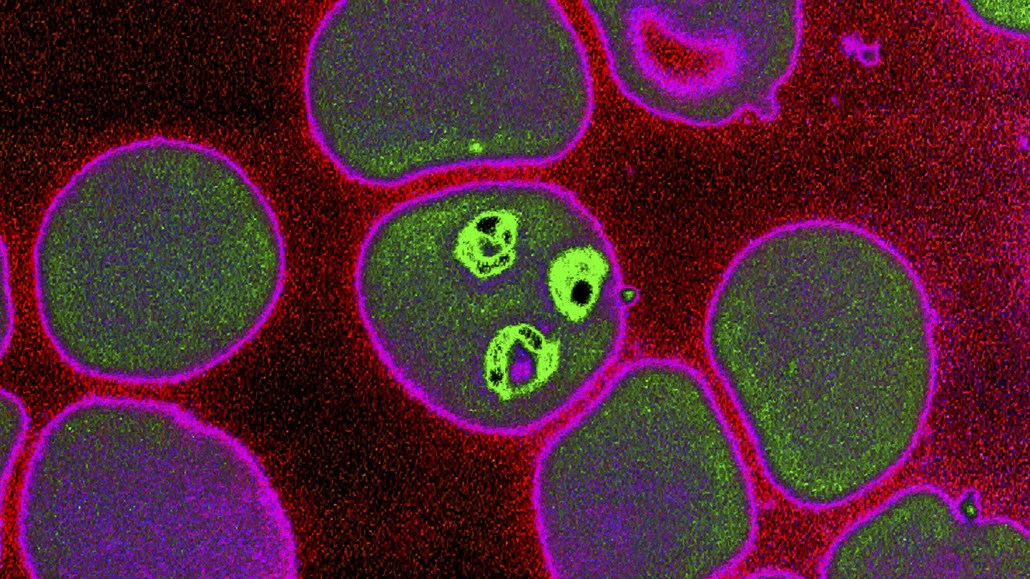 microscope image of Plasmodium falciparum parasites