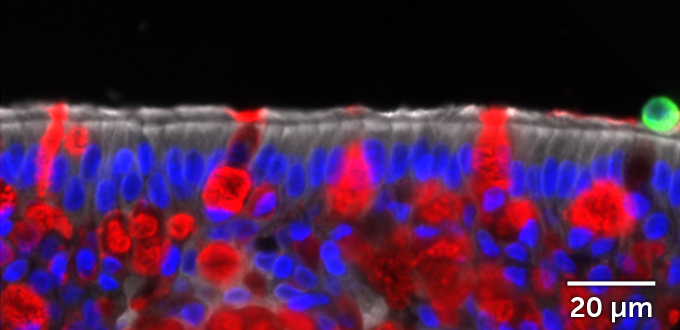 side view of human airway cells treated with the immune system protein interleukin-13, showing lots of mucus and rare SARS-CoV-2 infections
